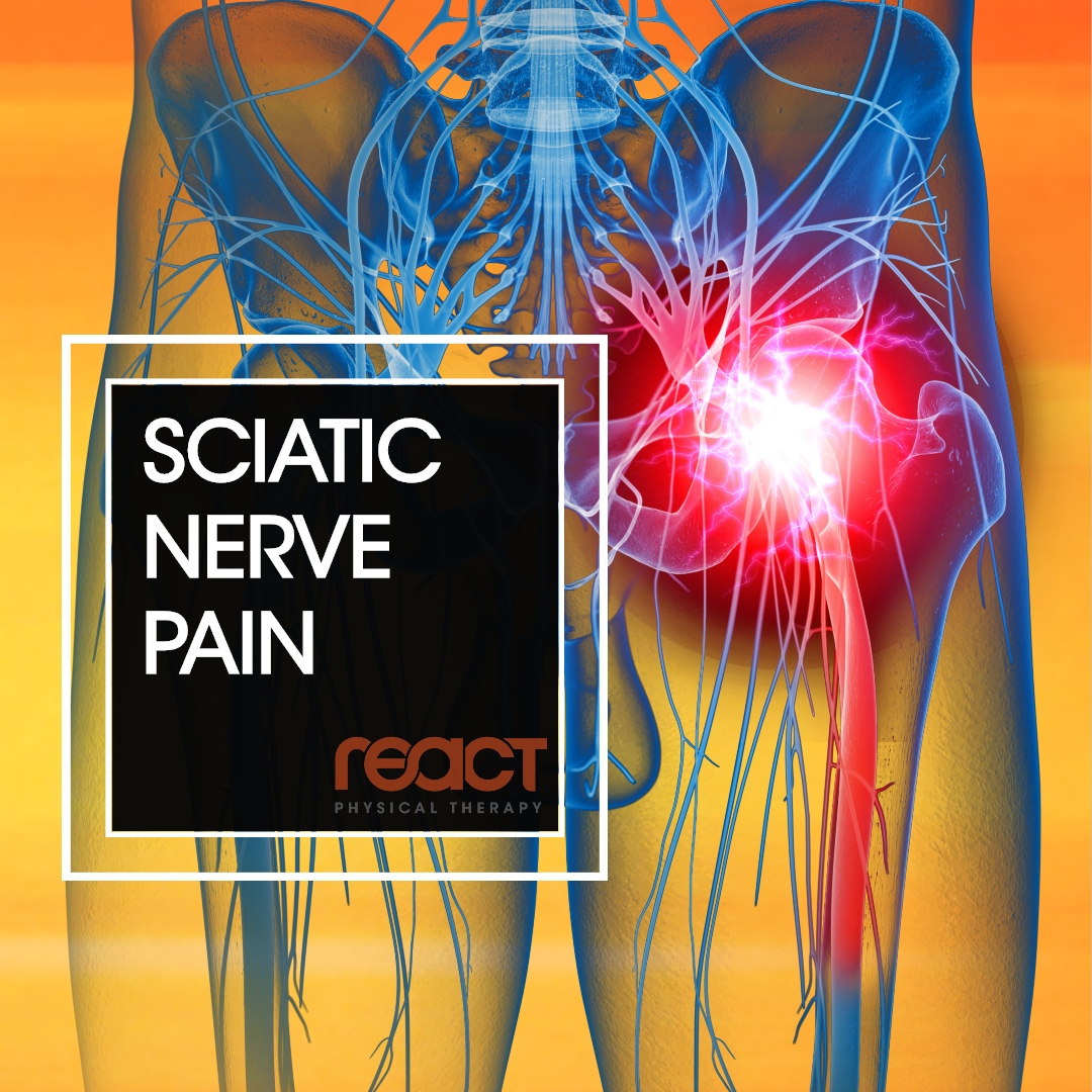 Sciatic Nerve Pain - React Physical Therapy