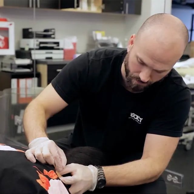 Man performing dry needling therapy